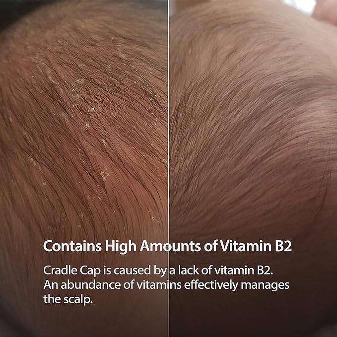 Korean Baby Shampoo & Bath with Natural Surfactants | Gentle Wash for Eczema, Cradle Cap 11.15 Fl.