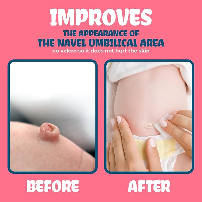 Patented-Baby Belly Button Shaper Plug- Baby Belly Band - Hernia Belt