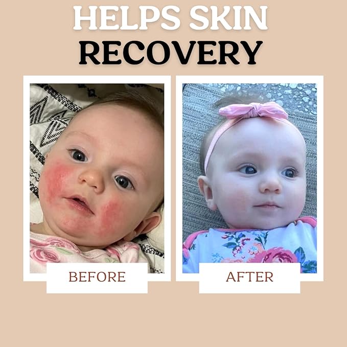 Baby Body & Face Biome Barrier Cream Lotion Ointment | Hydrating, Soothing