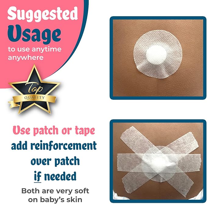 Patented-Baby Belly Button Shaper Plug- Baby Belly Band - Hernia Belt