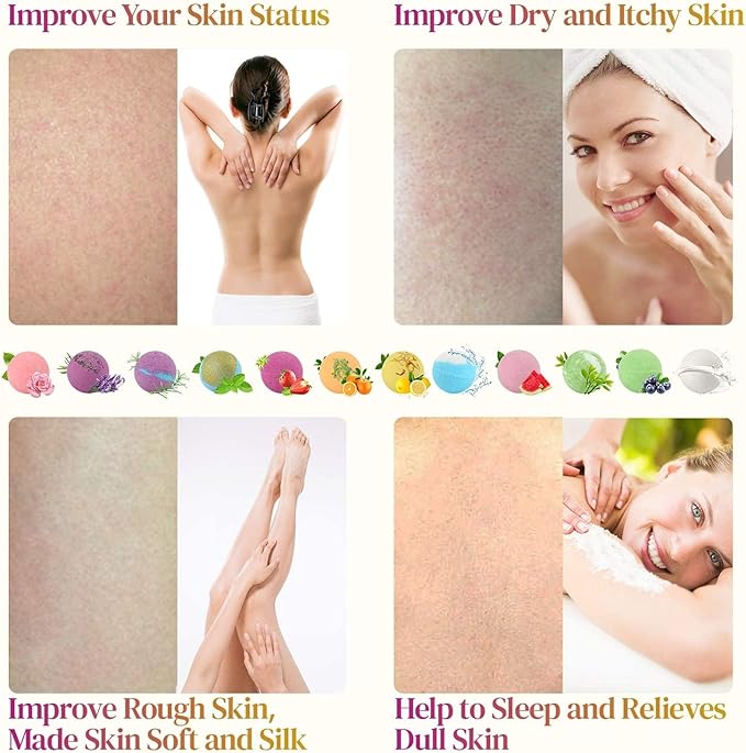 Bath Bombs, 12 PCS Bath Bombs for Women Kids Toddlers Adults