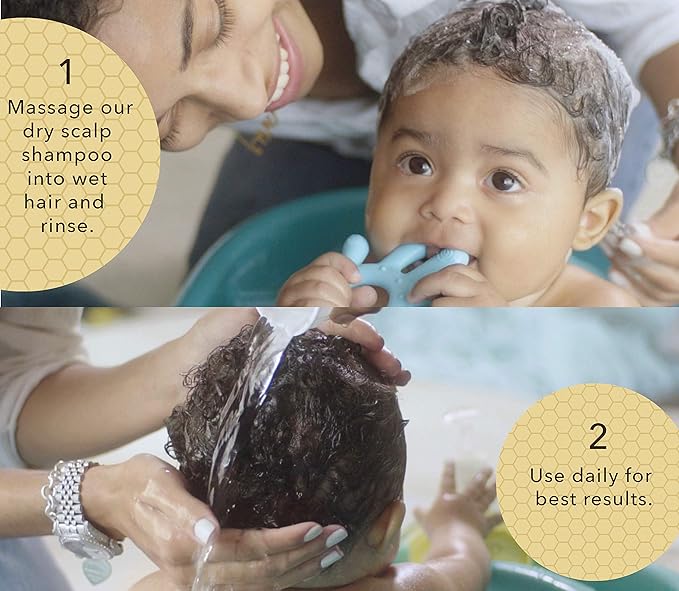 Bella B Bee Gone Cradle Cap Baby Shampoo (2-Pack), Treatment